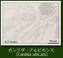 性器カンジダ症
